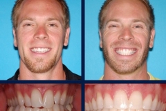 before-and-after1