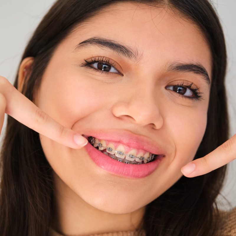 payment plan for braces
